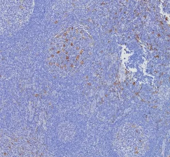 CD163L1 Antibody - image 1