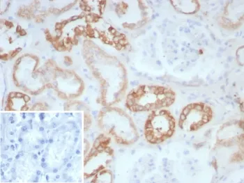 Collagen II Recombinant Antibody / COL2A1 - image 1