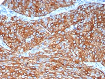 Keratin 6A Recombinant Antibody / Cytokeratin 6A - image 1