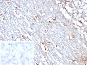 STAT6 Recombinant Antibody - image 1