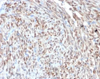 CDK4 Recombinant Antibody - image 1