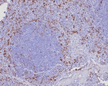 CD162 Recombinant Antibody / P selectin glycoprotein ligand 1 / PSGL-1 - image 1