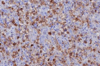 CD162 Recombinant Antibody / P selectin glycoprotein ligand 1 / PSGL-1 - image 1
