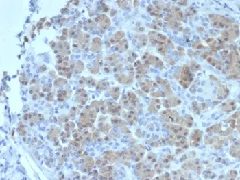 BRCA2 Antibody - image 1