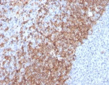 IgD Heavy Chain Recombinant Antibody - image 1