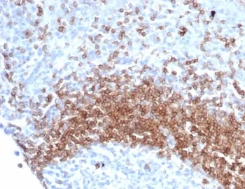 IgD Heavy Chain Recombinant Antibody - image 1