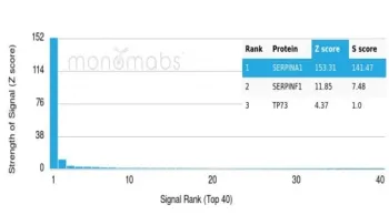 Alpha 1 Antitrypsin Antibody / AAT / SERPINA1 - image 1