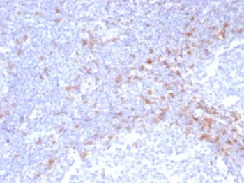 IgD Heavy Chain Recombinant Antibody - image 1