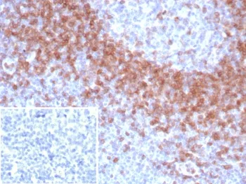 IgD Heavy Chain Recombinant Antibody - image 1