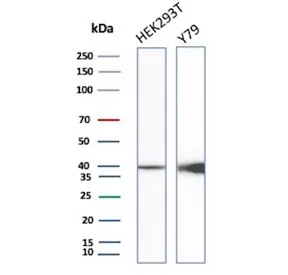 CKB Recombinant Antibody / Creatine kinase B - image 1