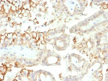 B7-H3 Antibody / CD276 - image 1