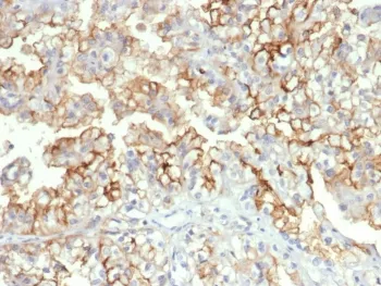 B7-H3 Antibody / CD276 - image 1