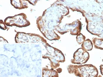 IMP3 Recombinant Antibody / Insulin like growth factor 2 mRNA binding protein 3 - image 1