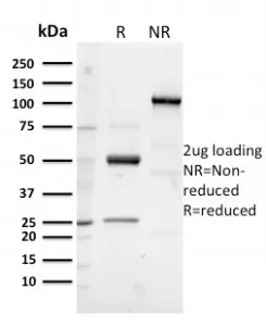 Glycoprotein 2 Recombinant Antibody / GP2 / ZAP75 - image 1