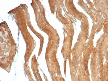 SMMHC Recombinant Antibody / Smooth Muscle Myosin Heavy Chain - image 1