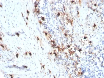 TPSAB1 Recombinant Antibody / Mast Cell Tryptase - image 1