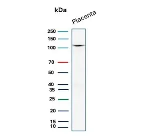 E-Cadherin Recombinant Antibody / CDH1 - image 1