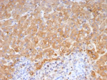 Haptoglobin Antibody - image 1
