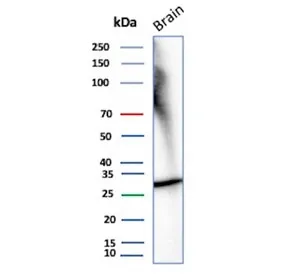 Calretinin / Calbindin 2 Recombinant Antibody - image 1