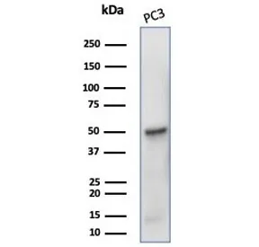 Beta Tubulin Recombinant Antibody / TUBB3 - image 1