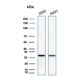 14-3-3 epsilon Recombinant Antibody / YWHAE - image 1