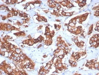 HER2 Recombinant Antibody / ErbB2 - image 1