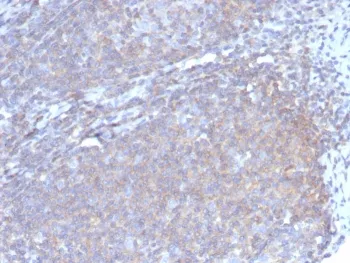 CSF3 Antibody / Granulocyte-Colony Stimulating Factor - image 1