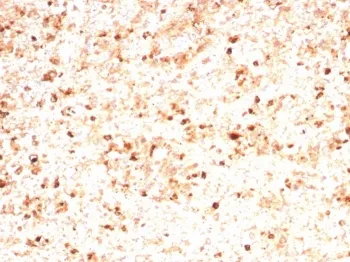 MPO Recombinant Antibody / Myeloperoxidase - image 1