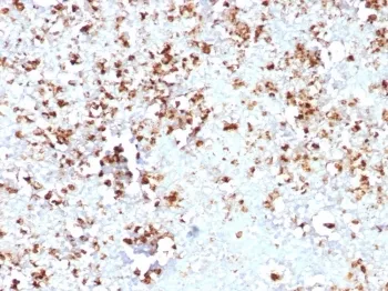 MPO Recombinant Antibody / Myeloperoxidase - image 1