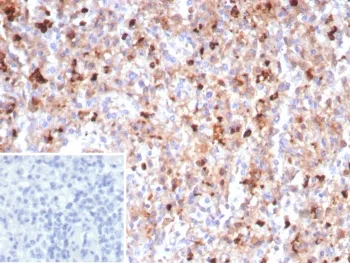 MPO Recombinant Antibody / Myeloperoxidase - image 1