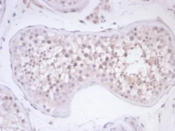 Survivin Antibody / BIRC5 - image 1