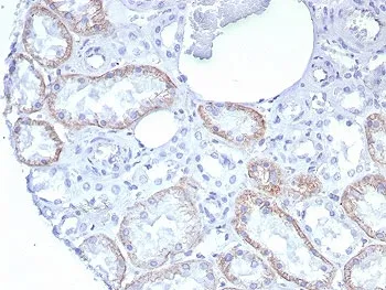 N-Cadherin Recombinant Antibody / CDH2 - image 1