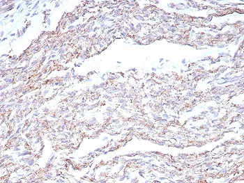 N-Cadherin Recombinant Antibody / CDH2 - image 1