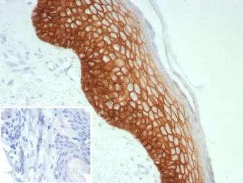 Desmoglein 3 Recombinant Antibody / DSG3 - image 1
