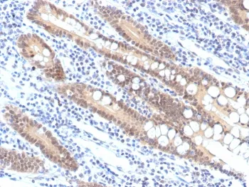 SMAD4 Recombinant Antibody - image 1