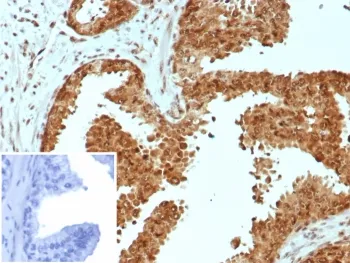 CARM1 Antibody / PRMT4 - image 1