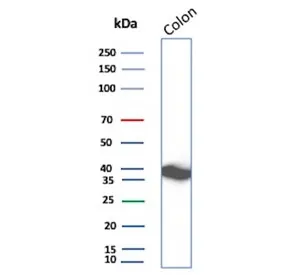 Calponin 1 Recombinant Antibody - image 1