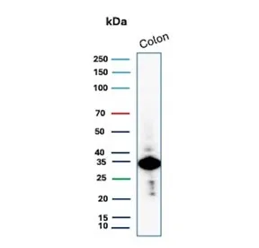 Calponin-1 Recombinant Antibody - image 1