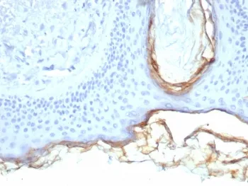 Kallikrein 5 Antibody / KLK5 - image 1