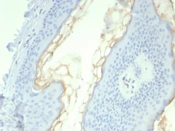 Kallikrein 5 Antibody / KLK5 - image 1