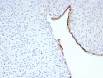 Uroplakin 3B Recombinant Antibody / UPK3B - image 1
