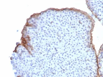 Uroplakin 3B Recombinant Antibody / UPK3B - image 1