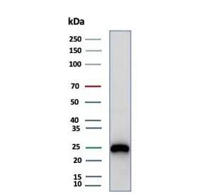 CD79a Recombinant Antibody - image 1