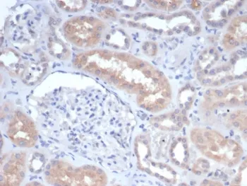 GCLM Antibody / Glutamate-Cysteine Ligase Regulatory Subunit - image 1