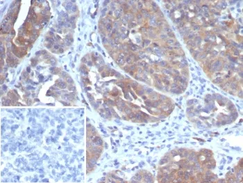 GCLM Antibody / Glutamate-Cysteine Ligase Regulatory Subunit - image 1