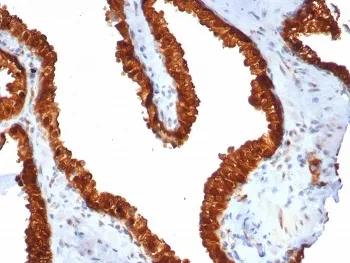 TROP2 Recombinant Antibody / TACSTD2 - image 1