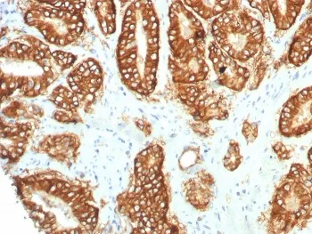 TROP2 Recombinant Antibody / TACSTD2 - image 1