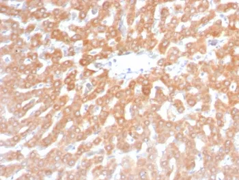 SDHB Recombinant Antibody / Succinate dehydrogenase B - image 1