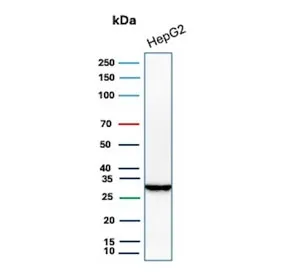 SDHB Recombinant Antibody / Succinate dehydrogenase B - image 1