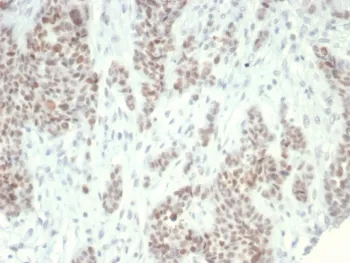 LSD1 Antibody / Lysine-Specific Demethylase 1 - image 1